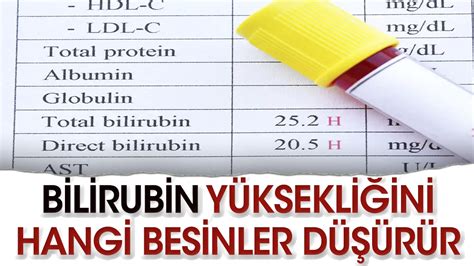 bilirubin yüksekliği